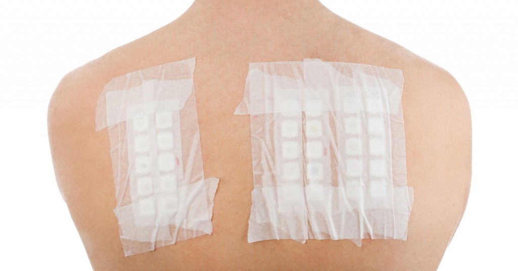 Patch Testing at Lotus Dermatology